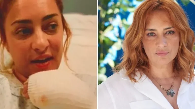 María Julia Oliván mostró cómo quedó su brazo tras el terrible accidente con una estufa